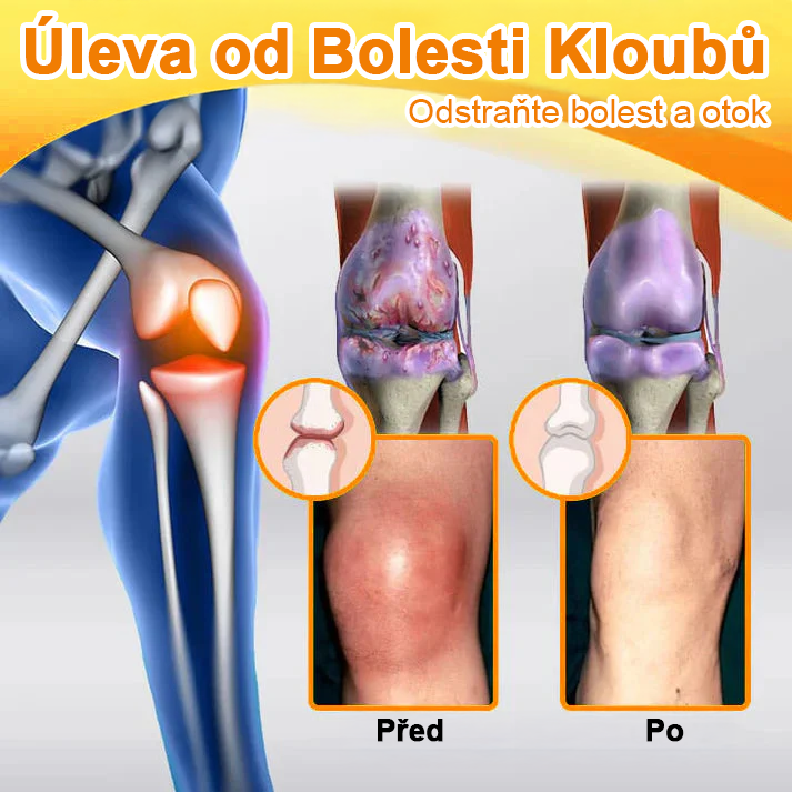 ✅Oficiální obchod: Ourlyard™ Hořčíkový olej a medový sprej na opravu kloubů👨⚕️Schváleno Evropskou agenturou pro léčivé přípravky a zdravotnické prostředky (EMA)🔥
