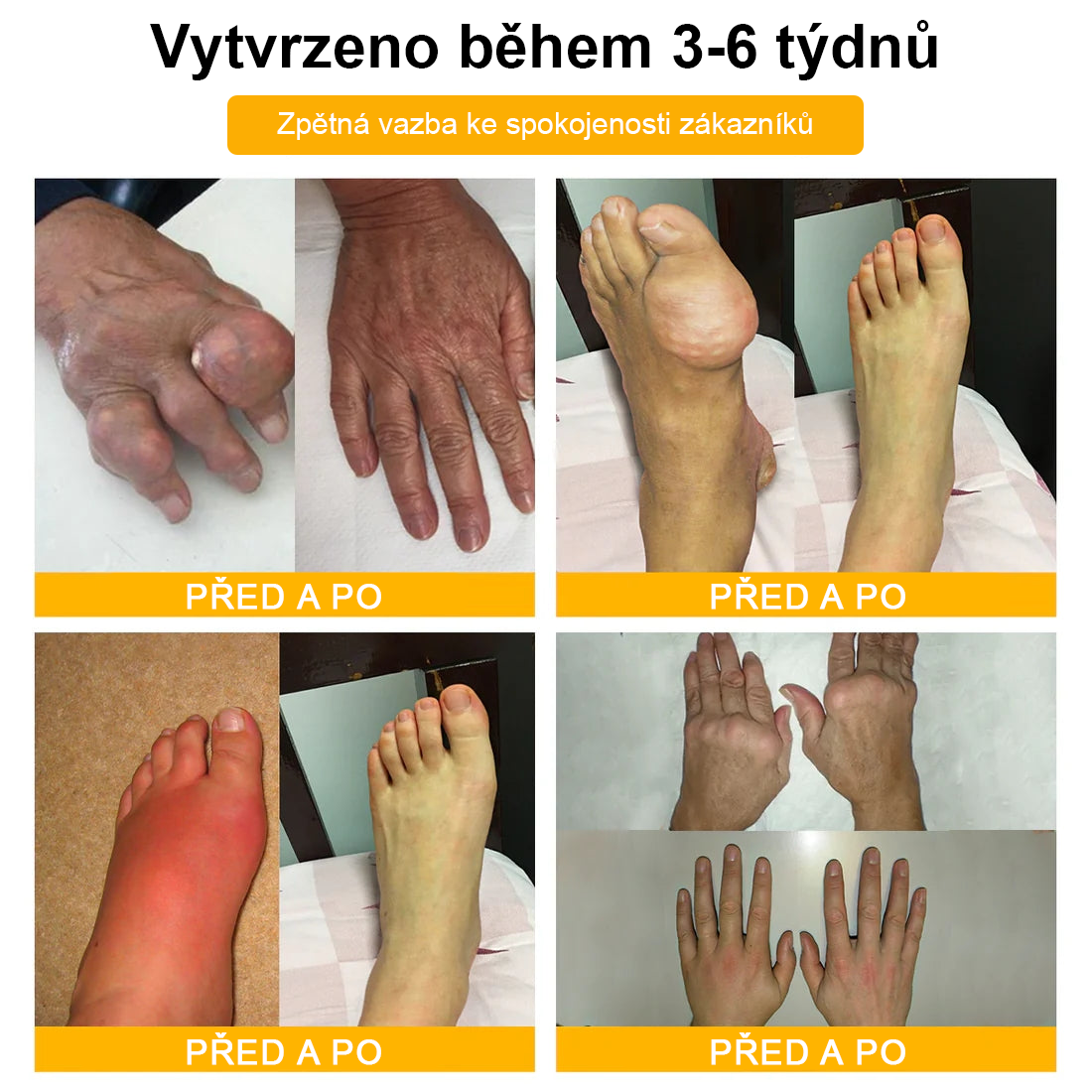 ✅Oficiální obchod: Ourlyard™ Hořčíkový olej a medový sprej na opravu kloubů👨⚕️Schváleno Evropskou agenturou pro léčivé přípravky a zdravotnické prostředky (EMA)🔥
