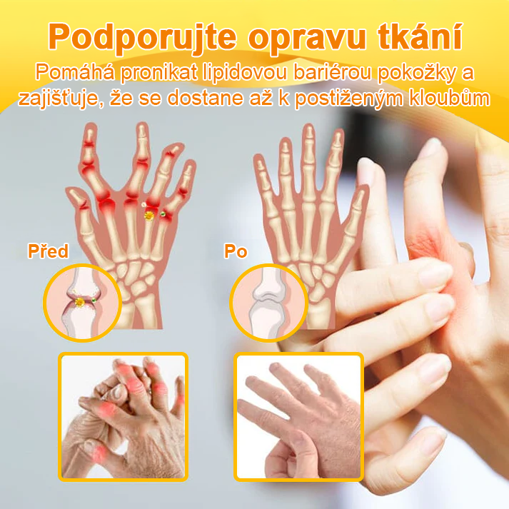 ✅Oficiální obchod: Ourlyard™ Hořčíkový olej a medový sprej na opravu kloubů👨⚕️Schváleno Evropskou agenturou pro léčivé přípravky a zdravotnické prostředky (EMA)🔥