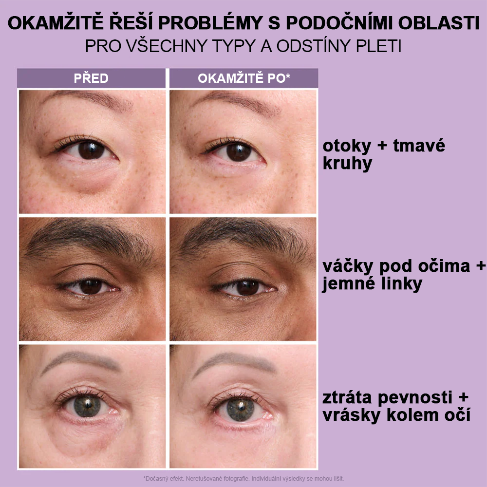 🌸Okamžitý zpevňovač očí Snadno použitelná formule – Dokonalý lifting a hladký finiš✨