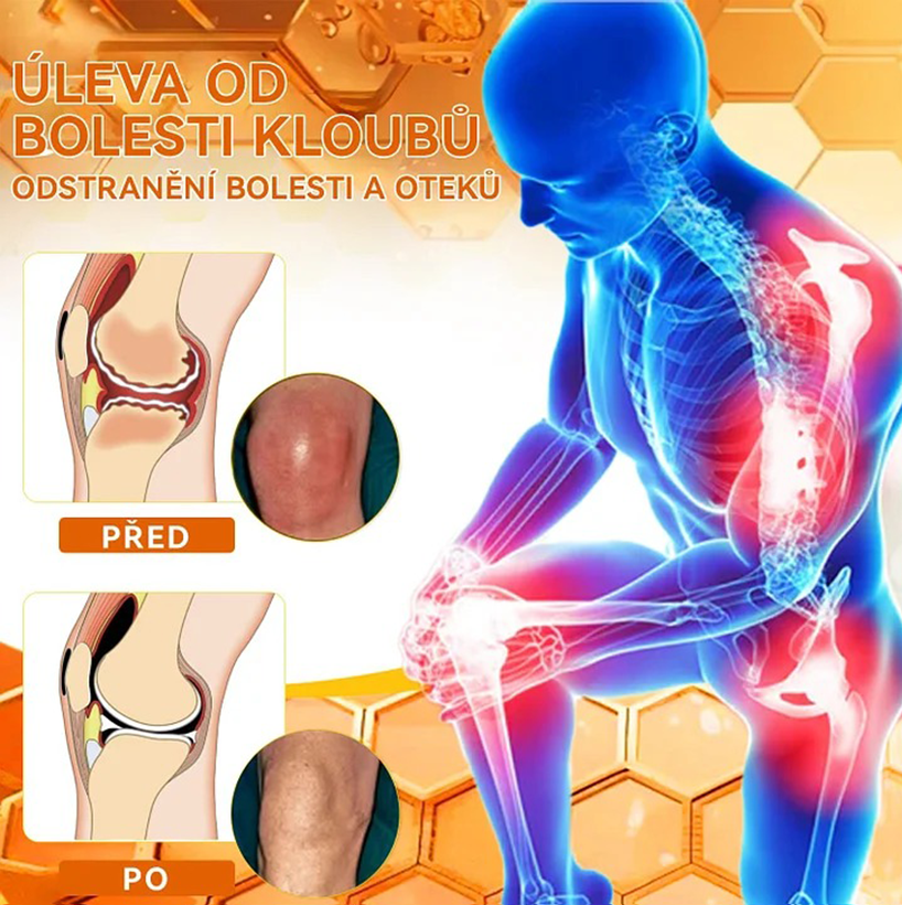 ✅Oficiální obchod: Ourlyard™ Hořčíkový olej a medový sprej na opravu kloubů👨⚕️Schváleno Evropskou agenturou pro léčivé přípravky a zdravotnické prostředky (EMA)🔥