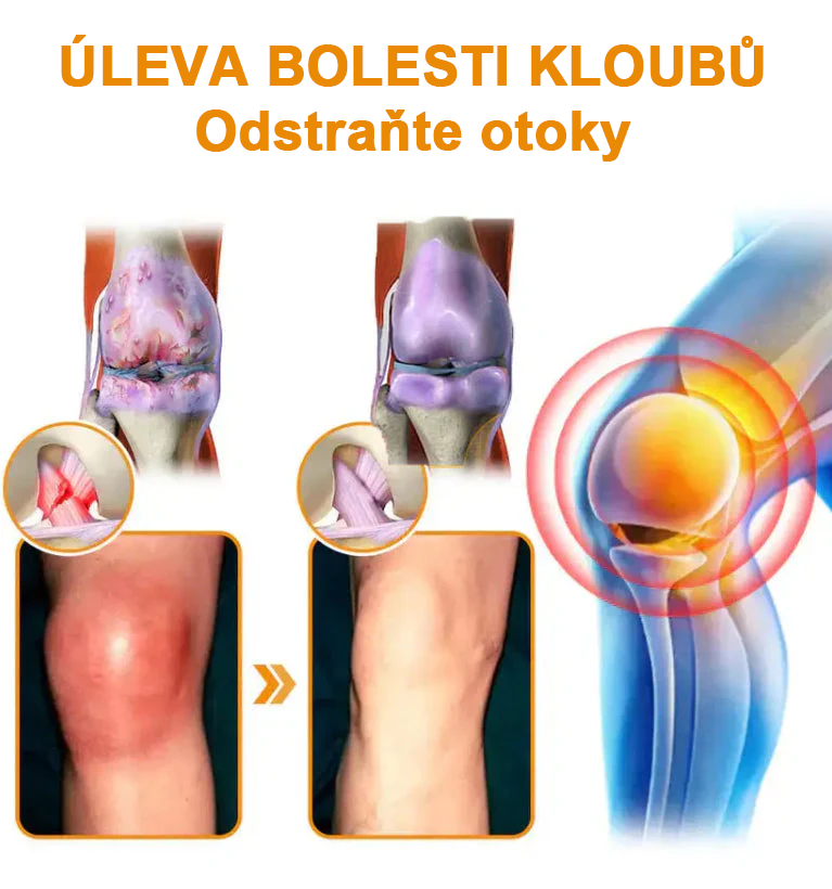 ✅Oficiální obchod: Ourlyard™ Hořčíkový olej a medový sprej na opravu kloubů👨‍⚕️Schváleno Evropskou agenturou pro léčivé přípravky a zdravotnické prostředky (EMA)🔥