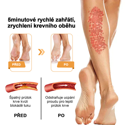 ⏰ RevivaFoot™ Mélthin lymfatické odvodňovací a zeštíhlující šumivé koule do koupele na nohy, snižují otoky až o 70 %【Podpora lymfatického oběhu – řešení problému od samotné příčiny】⏰