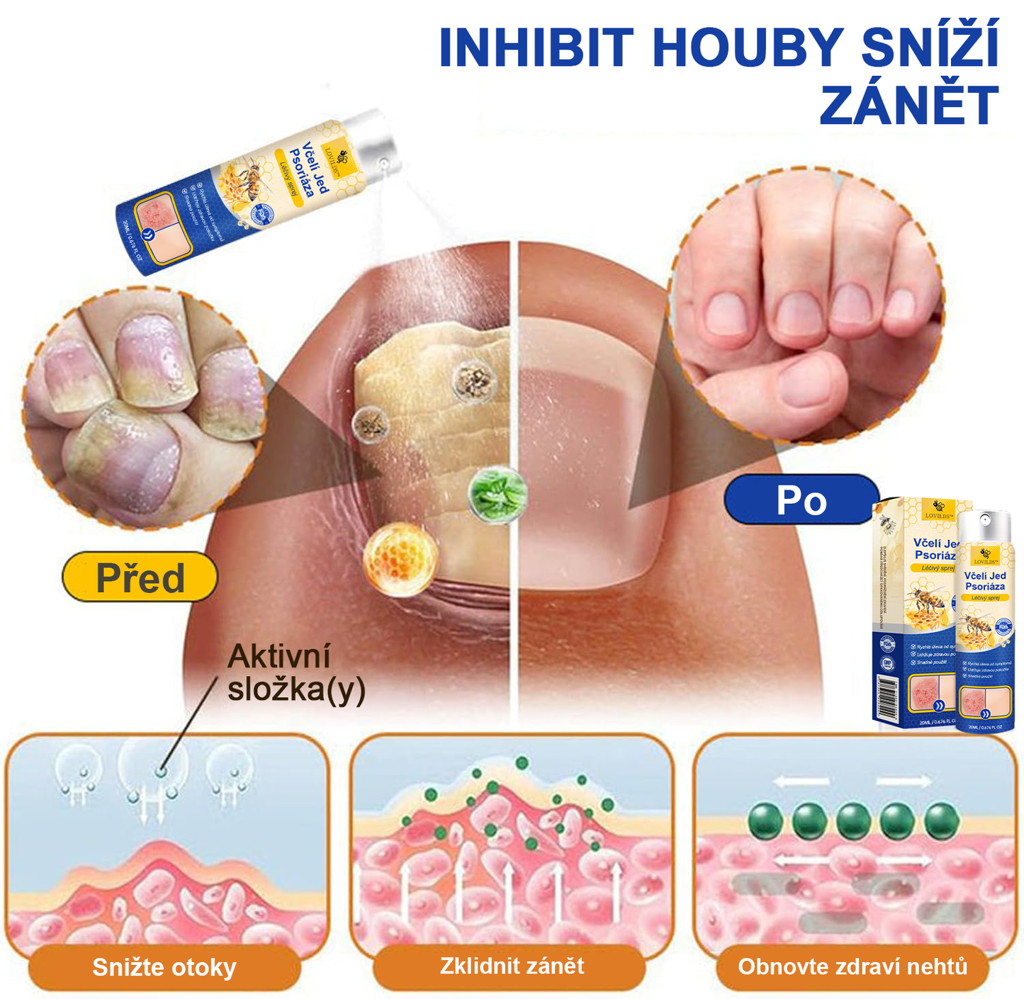 🔥Platba při převzetí🔥 60% sleva LOVILDS™ PsoriaHeal sprej na lupénku (doručení po celém světě – doprava zdarma)