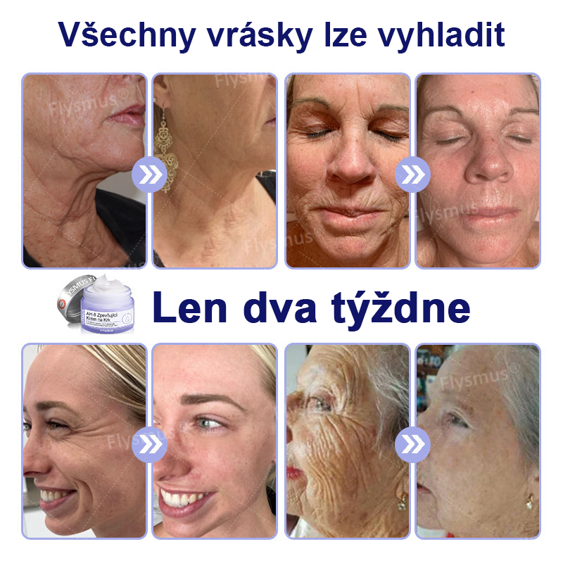🎁Speciální nabídka – Flysmus® AH-8 Krém na zpevnění a lifting krku – Poslední den se slevou 70 %