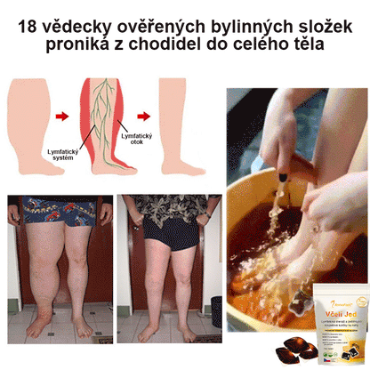 ⏰ RevivaFoot™ Mélthin lymfatické odvodňovací a zeštíhlující šumivé koule do koupele na nohy, snižují otoky až o 70 %【Podpora lymfatického oběhu – řešení problému od samotné příčiny】⏰