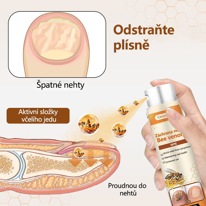 【Oficiální vlajkový obchod】Ceoerty® NailRescue Včelí jed ve spreji✅✅