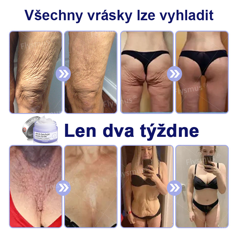 🎁Speciální nabídka – Flysmus® AH-8 Krém na zpevnění a lifting krku – Poslední den se slevou 70 %