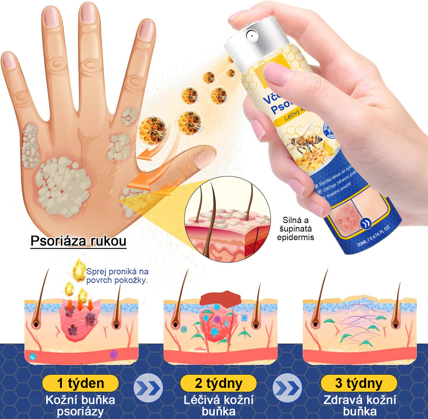 🔥Platba při převzetí🔥 60% sleva LOVILDS™ PsoriaHeal sprej na lupénku (doručení po celém světě – doprava zdarma)