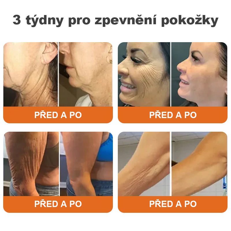 🎁Speciální nabídka – Flysmus® AH-8 Krém na zpevnění a lifting krku – Poslední den se slevou 70 %