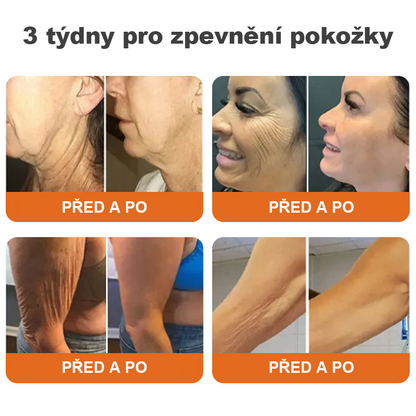 🎁Speciální nabídka – Flysmus® AH-8 Krém na zpevnění a lifting krku – Poslední den se slevou 70 %