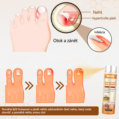 【Oficiální vlajkový obchod】Ceoerty® NailRescue Včelí jed ve spreji✅✅