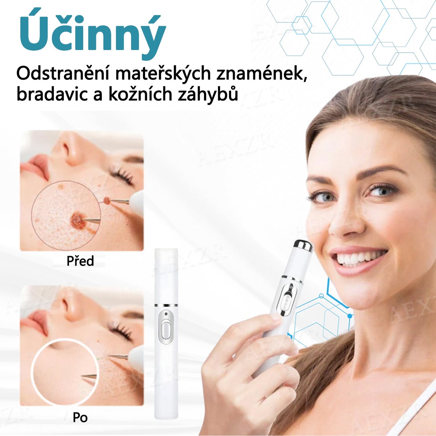 【Oficiální vlajkový obchod】Foulme® PRO Neinvazivní laserové pero na odstraňování bradavic a znamének💥