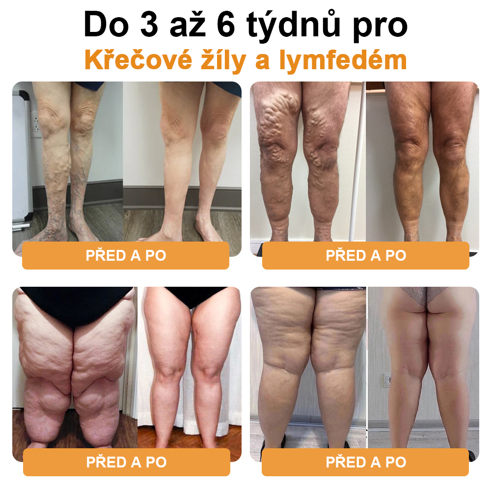 ⏰ RevivaFoot™ Mélthin lymfatické odvodňovací a zeštíhlující šumivé koule do koupele na nohy, snižují otoky až o 70 %【Podpora lymfatického oběhu – řešení problému od samotné příčiny】⏰