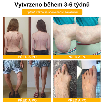 ✅Oficiální obchod: Ourlyard™ Hořčíkový olej a medový sprej na opravu kloubů👨‍⚕️Schváleno Evropskou agenturou pro léčivé přípravky a zdravotnické prostředky (EMA)🔥