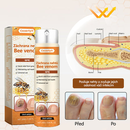 【Oficiální vlajkový obchod】Ceoerty® NailRescue Včelí jed ve spreji✅✅