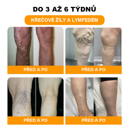 ⏰ RevivaFoot™ Mélthin lymfatické odvodňovací a zeštíhlující šumivé koule do koupele na nohy, snižují otoky až o 70 %【Podpora lymfatického oběhu – řešení problému od samotné příčiny】⏰