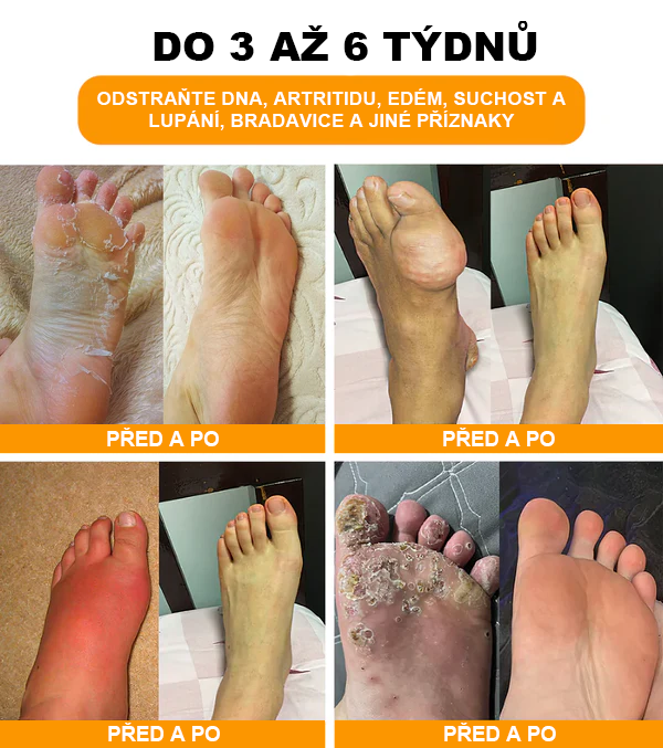 ⏰ RevivaFoot™ Mélthin lymfatické odvodňovací a zeštíhlující šumivé koule do koupele na nohy, snižují otoky až o 70 %【Podpora lymfatického oběhu – řešení problému od samotné příčiny】⏰