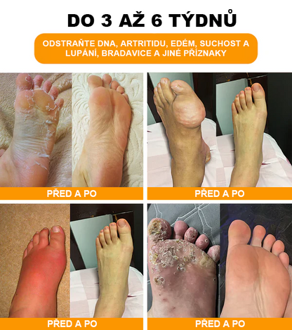 ⏰ RevivaFoot™ Mélthin lymfatické odvodňovací a zeštíhlující šumivé koule do koupele na nohy, snižují otoky až o 70 %【Podpora lymfatického oběhu – řešení problému od samotné příčiny】⏰