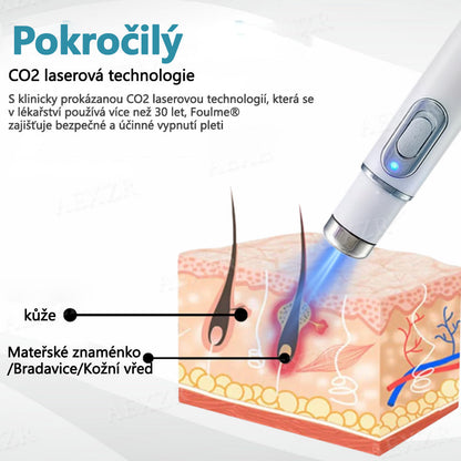 【Oficiální vlajkový obchod】Foulme® PRO Neinvazivní laserové pero na odstraňování bradavic a znamének💥
