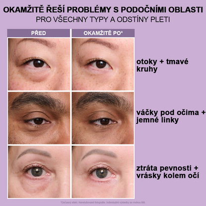 🌸Okamžitý zpevňovač očí Snadno použitelná formule – Dokonalý lifting a hladký finiš✨