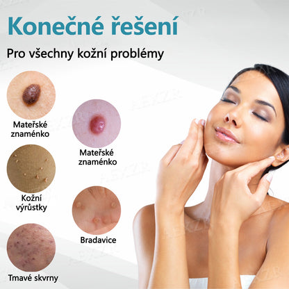【Oficiální vlajkový obchod】Foulme® PRO Neinvazivní laserové pero na odstraňování bradavic a znamének💥