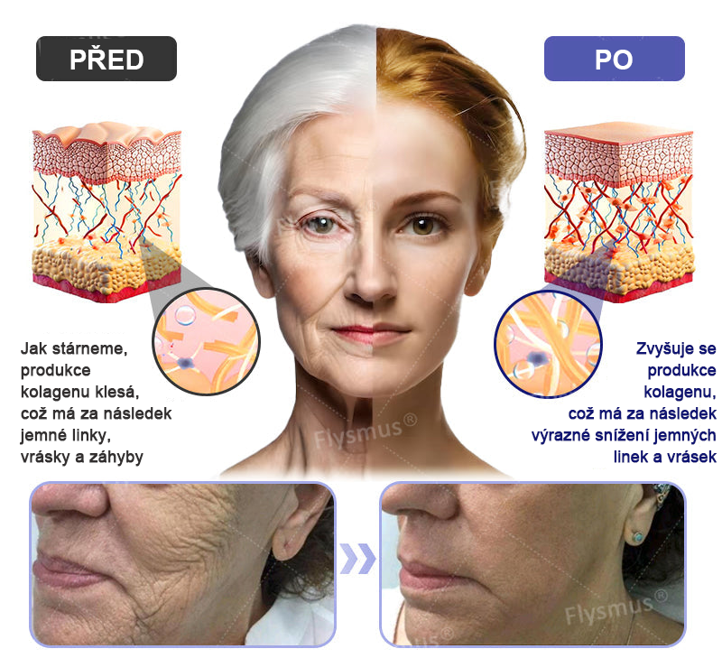 🎁Speciální nabídka – Flysmus® AH-8 Krém na zpevnění a lifting krku – Poslední den se slevou 70 %