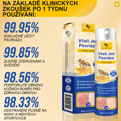 🔥Platba při převzetí🔥 60% sleva LOVILDS™ PsoriaHeal sprej na lupénku (doručení po celém světě – doprava zdarma)